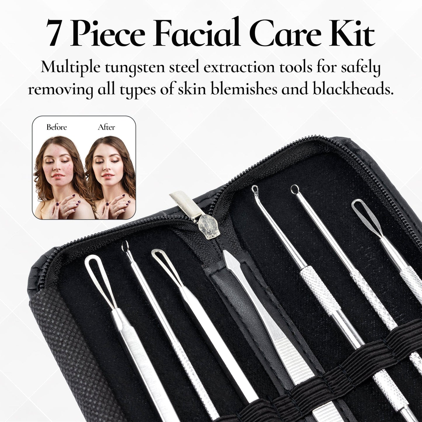 7 Piece Blackhead Removal Kit